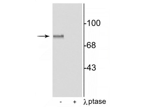 Western blot of rat brain lysate showing specific immunolabeling of the ~87 kDa MARCKS protein phosphorylated at Ser152,156, in the first lane (-). Phosphospecificity is shown in the second lane (+) where immunolabeling is completely eliminated by blot treatment with lambda phosphatase (λ-Ptase, 1200 units for 30 min).