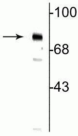 Western blot of neonatal rat brain showing specific immunolabeling of the ~75 kDa MeCP2 protein phosphorylated at Ser80.