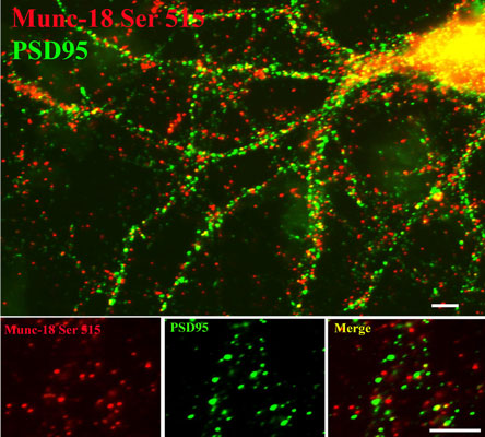 Immunostaining of 14 DIV rat cortical neurons showing specific labeling of Munc-18 phosphorylated at Ser513 (cat. p1305-515, 1:400,m red) and PSD95 (green).