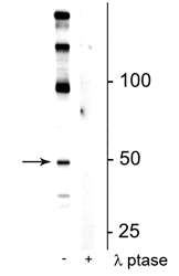 Western blot of mouse hippocampal lysate showing specific immunolabeling of the ~50 kDa eEF1A2 protein phosphorylated at Ser358 in the first lane (-). Phosphospecificity is shown in the second lane (+) where immunolabeling is completely eliminated by lysate treatment with lambda phosphatase (λ-Ptase, 800 units/1mg protein for 30 min). 