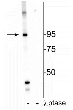 Western blot of HeLa cell lysate showing specific labeling of the ~95 kDa IR protein phosphorylated at Thr1160 in the first lane (-). Phosphospecificity is shown in the second lane (+) where immunolabeling is completely eliminated by blot treatment with lambda phosphatase (λ-Ptase, 1200 units for 30 min).