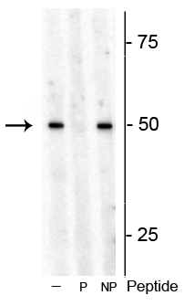 Western blot of Arabidopsis lysate showing specific immunolabeling of the ~53 kDa S6K1 phosphorylated at Thr449 in the first lane (-). Phosphospecificity is shown in the second lane (P) where immunolabeling is blocked by preadsorption with the phosphopeptide used as antigen, but not by the corresponding non-phosphopeptide in the third lane (NP). 