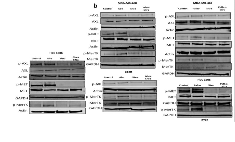 Immunoblot was performed on cell lines treated for 24 h with Abe (2 μm), Palbo (5 μm), and/or Sitra (2 μm). Protein levels were determined for phospho-AXL, phosho-MET, and phosho-MERTK (cat. p186-749). Image from publication CC-BY-4.0. PMID: 38927958