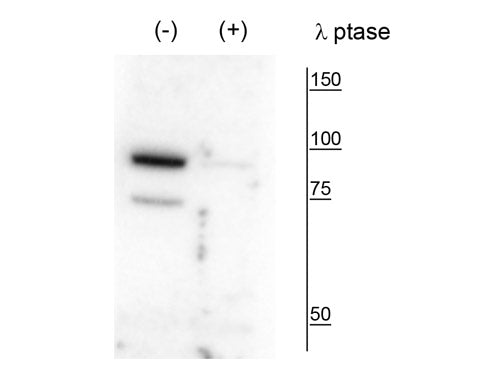 Western blot of mouse whole brain lysate showing specific labeling of the ~86 kDa PanK4 phosphorylated at Ser63 in the first lane (-). Phosphospecificity is shown in the second lane (+) where immunolabeling is nearly eliminated with lambda phosphatase (λ-Ptase, 1200 units for 30 minutes).