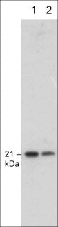 Western blot analysis of p21 expression in human endothelial cells (lanes 1 & 2). The blots were probed with mouse monoclonal anti-p21 at 1:250 (lane 1) and 1:1000 (lane 2).