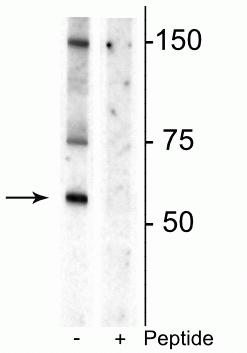 Western blot of rat striatal lysate showing specific immunolabeling of the ~55 kDa glycosylated form of the DAT protein phosphorylated at Thr53 in the first lane (-). Phosphospecificity is shown in the second lane (+) where immunolabeling is blocked by preadsorption of the phosphopeptide used as the antigen, but not by the corresponding non-phosphopeptide (not shown). 