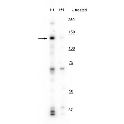 Western blot of mouse whole brain lysate showing specific labeling of the ~130 kDa IRE1 protein phosphorylated at Ser724 in the first lane (-). Phosphospecificity is shown in the second lane (+) where the immunolabeling is eliminated by blot treatment with lambda phosphatase (1200 units for 30 minutes).