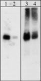 Western blot analysis of A431 cells. The blot was probed with rabbit polyclonal anti-Paxillin (PP1161) at 1:500 & 1:2000 (lanes 1 & 2) or with mouse monoclonal anti-Paxillin (PM1071) at 1:2000 & 1:5000 (lanes 3 & 4).