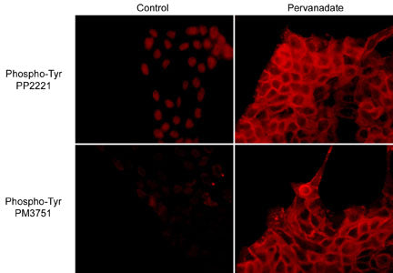 Immunocytochemical labeling of phosphotyrosine in control and pervanadate-treated A431 cells. The cells were labeled with rabbit polyclonal anti-Phosphotyrosine (PP2221) and mouse monoclonal anti-Phosphotyrosine (PM3751), then the antibodies were detected using appropriate secondary antibodies conjugated to Cy3.