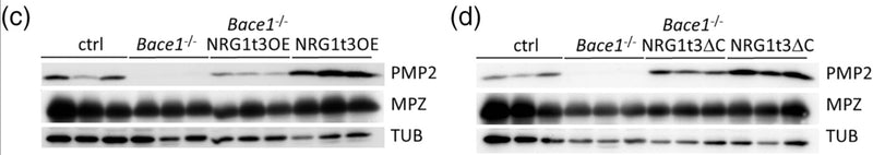 Western blot analysis of PMP2 and MPZ (cat. PZO, 1:5000)  in control, Bace1−/−, NRG1t3OE, Bace1−/−; NRG1t3OE, NRG1t3ΔC (Constitutively active NRG1 type III) and Bace1−/−; NRG1t3ΔC at 60 days of age (C,D). Tubulin (TUB) was used for the endogenous control for the Western blots. Image from publication CC-BY-4.0. PMID:38311982