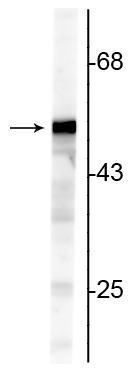 Western blot of NIH 3T3 cell lysate showing specific immunolabeling of the ~50 kDa Vimentin protein.