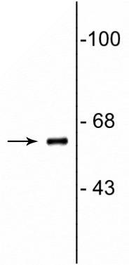 Western blot of neonatal rat brain lysate showing specific immunolabeling of the ~62 kDa COBRA1 protein. 