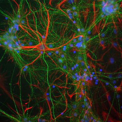 Anti-NFM (Neurofilament Medium Chain) Antibody