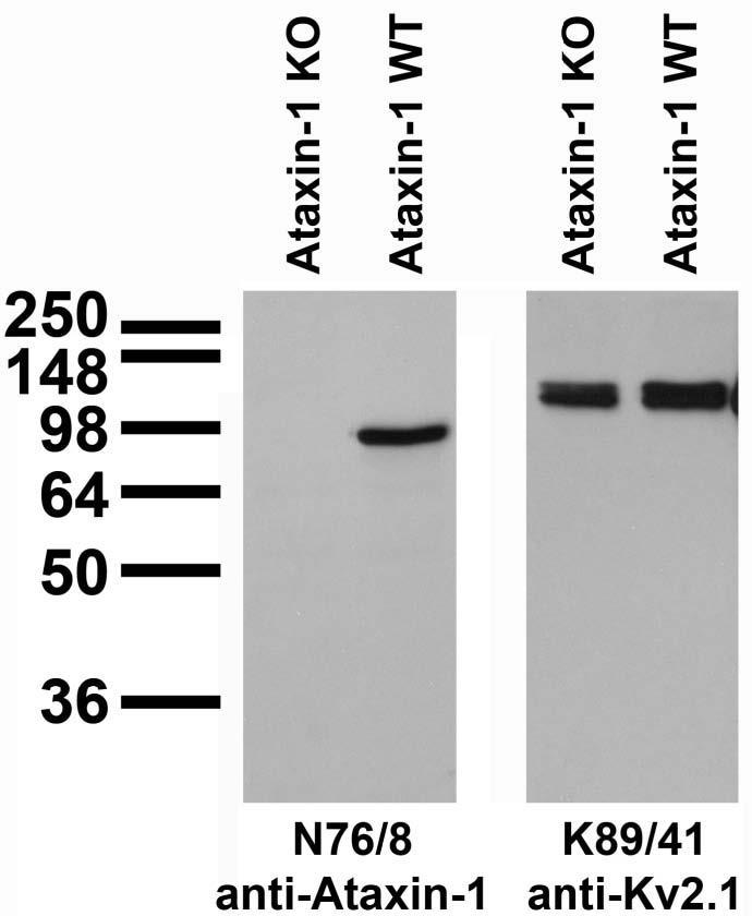 Adult rat brain immunoblot: extracts of cerebella from Ataxin-1 KO and WT mice and probed with N76/8 (left) or K89/41 (right) TC supe.
