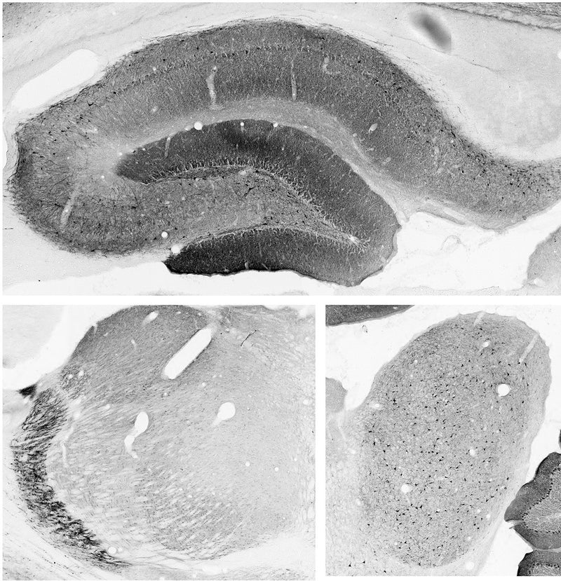 Adult rat hippocampus (top), thalamus (bottom left) and superior colliculus (bottom right) immunohistochemistry with antigen retrieval via pepsin pretreatment.
